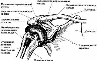 Как лечить артроз акромиально ключичного сочленения?