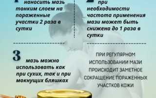 Как лечить псориаз медом?