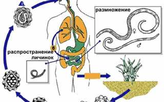Лечение глистов у детей