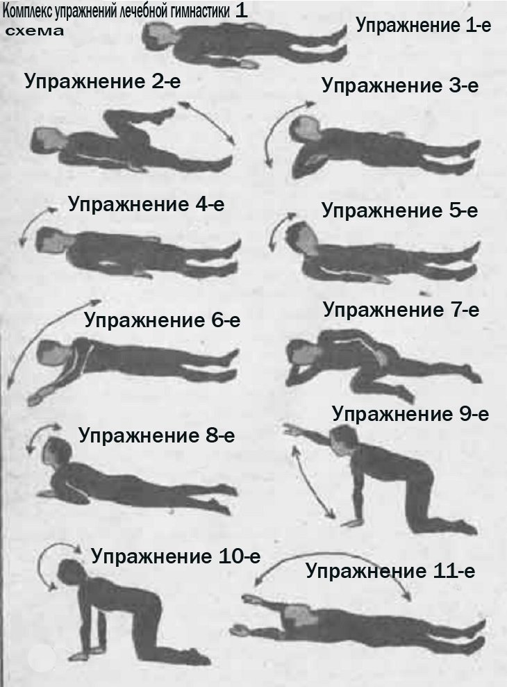 Лечебная гимнастика для шейных мышц