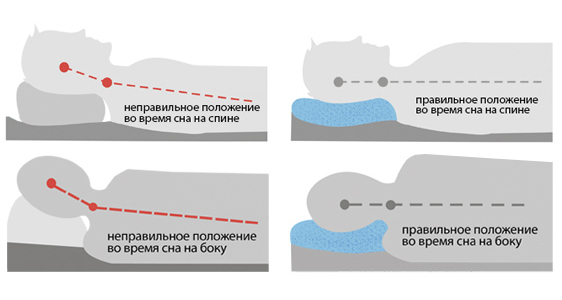 Правильное и неправильное положение во время сна