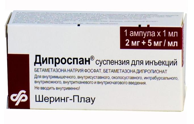 Дипроспан при лечении артроза