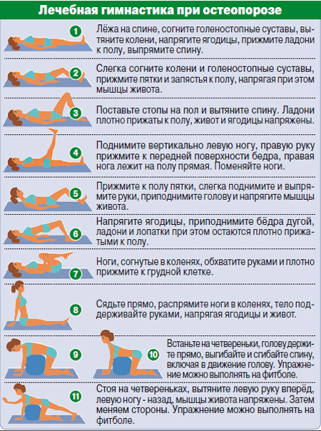 Лечебные упражнения при остеопорозе