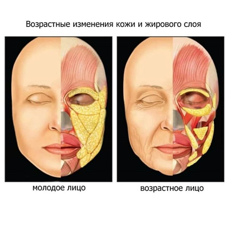 Причины появления жировых складок