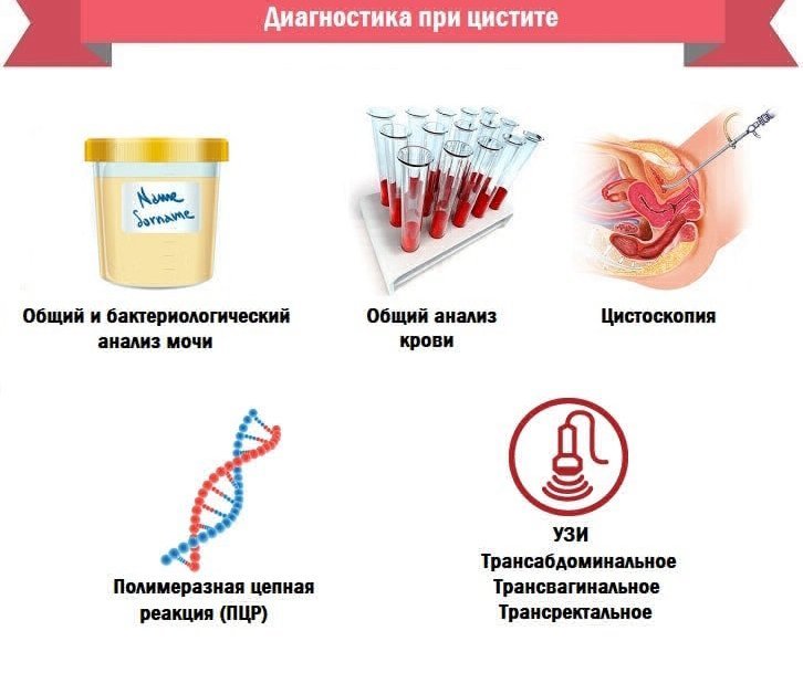 Диагностика при цистите
