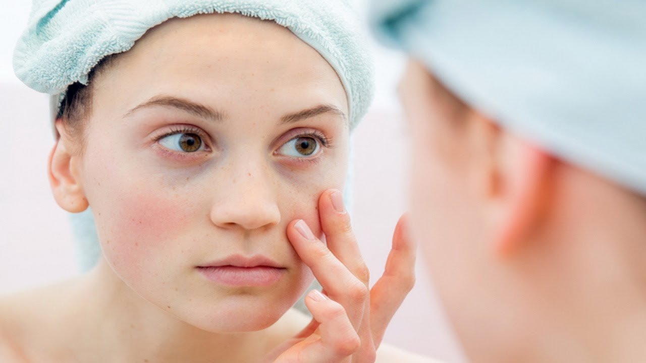 Мази от красных пятен