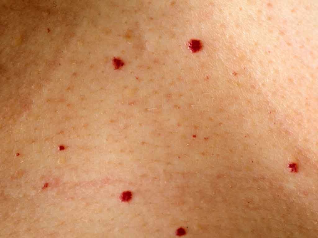 Причины появления красных точек