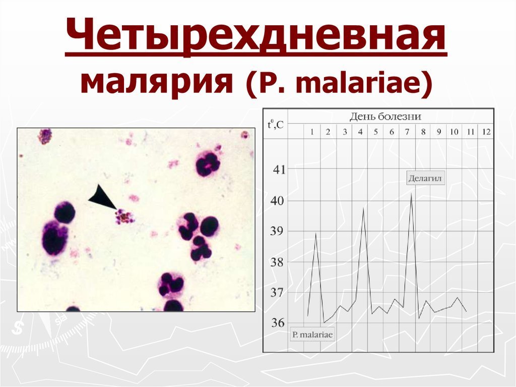Четырёхдневная малярия