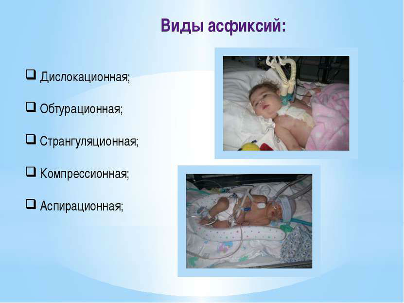Виды асфиксии