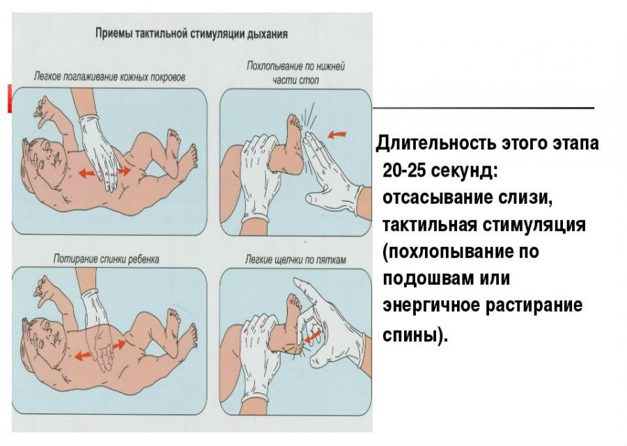 Тактильная стимуляция дыхания