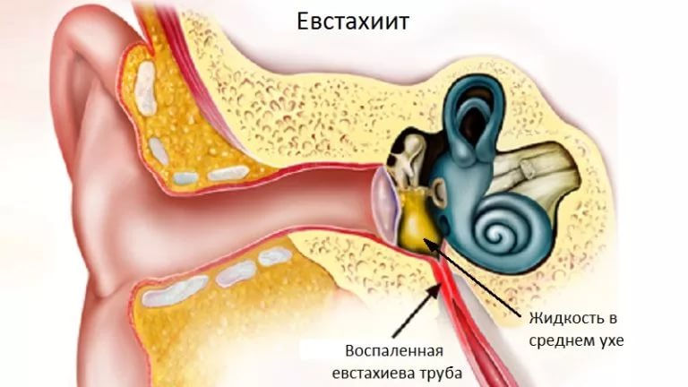 Евстахиит
