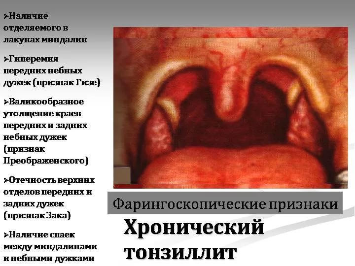 Красное горло