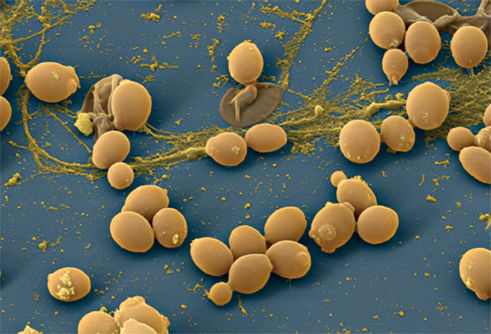 Дрожжевые грибки рода Candida Дрожжевые грибки рода Candida