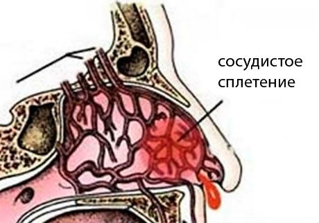 Сосуды носа