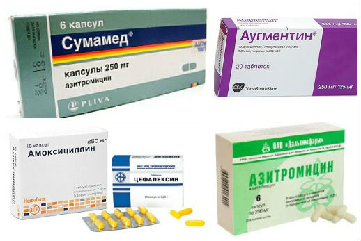 Антибиотики широкого спектра действия