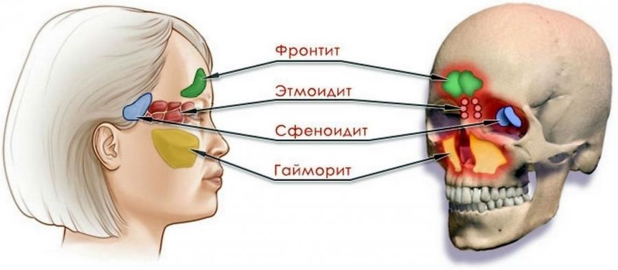 Синусы