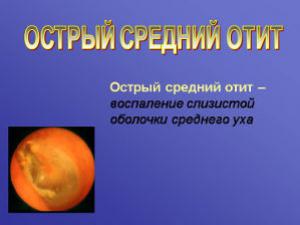 Острый отит