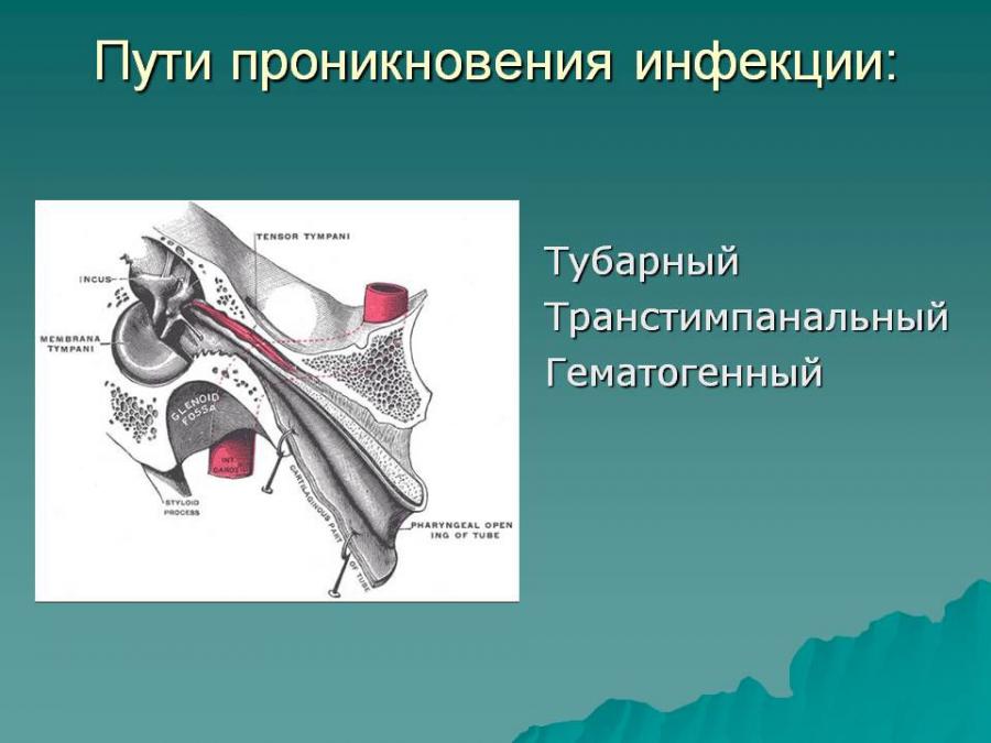 Пути проникновения инфекции