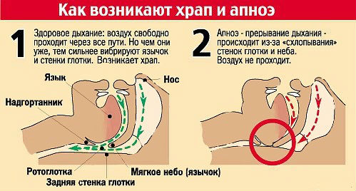 Храп Храп