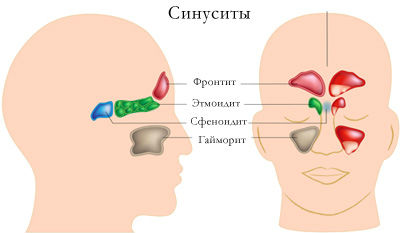 Околоносовые пазухи Околоносовые пазухи