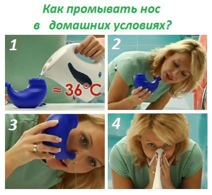 Как промывать нос