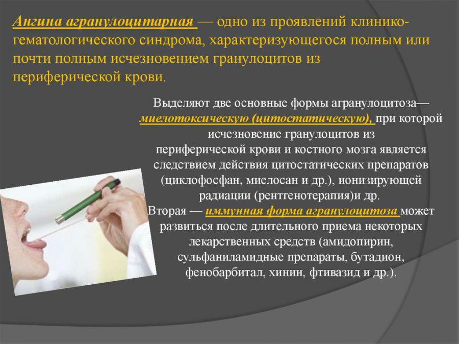 Агранулоцитарная ангина